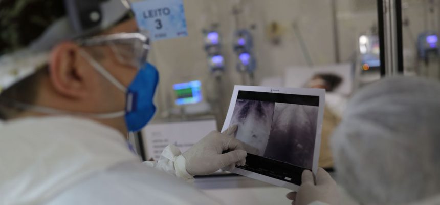 O chefe do médico da UTI, Everton Padilha Gomes, examina uma radiografia de tórax de um paciente em um hospital de campo criado para tratar pacientes que sofrem da doença por coronavírus (COVID-19) em Guarulhos, São Paulo