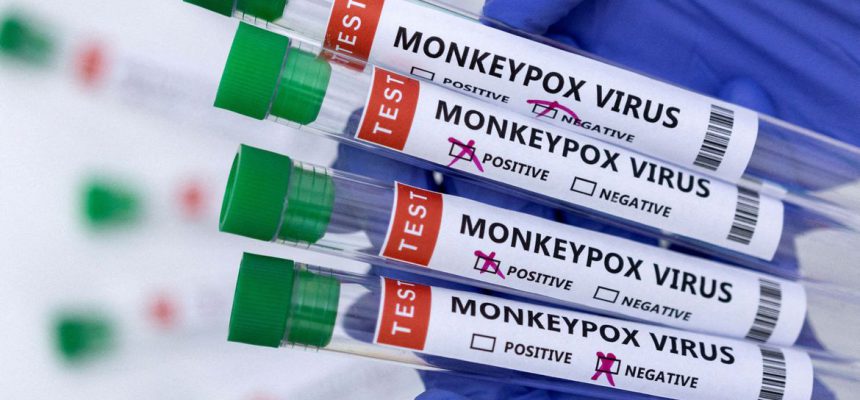 2022-06-03t180308z_672422886_rc25du9i2yos_rtrmadp_3_health-monkeypox-usa