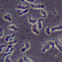 ameba-naegleria-fowleri-conhecida-como-ameba-comedora-de-cerebros-1690901559352_v2_900x506